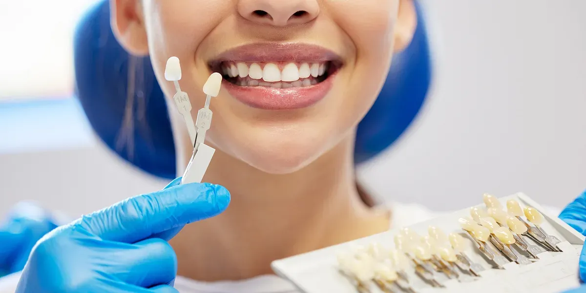 Can You Get Veneers with Crooked or Missing Teeth?