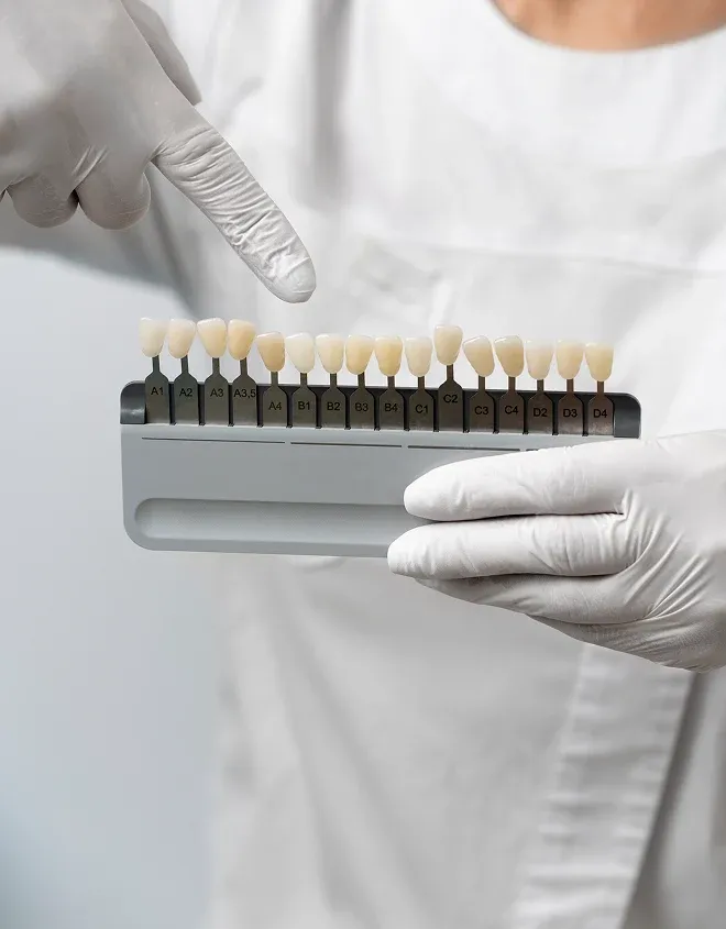 Can You Get Veneers with Crooked or Missing Teeth?