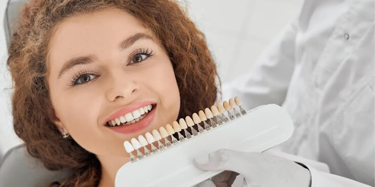 How Long Do Veneers Last? Durability and Replacement Guide